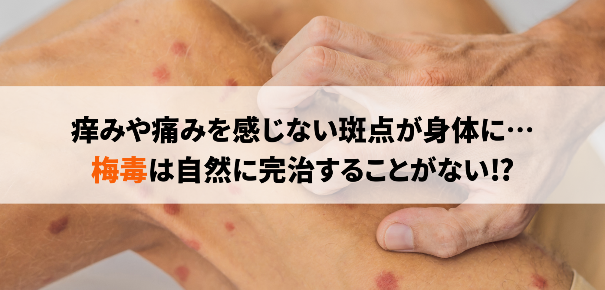 梅毒とは？原因・感染経路や症状、相談窓口、検査・治療方法などを徹底解説！【医師監修】